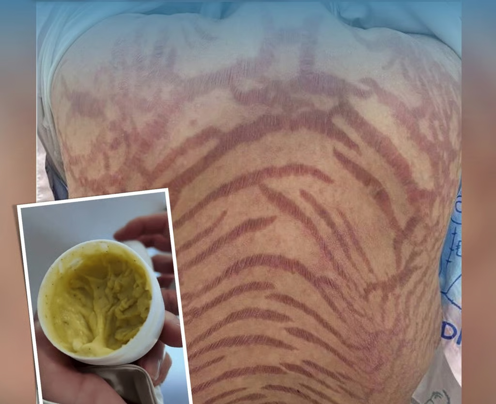 କ୍ରିମ ବଦଳାଇଲା ଜୀବନ