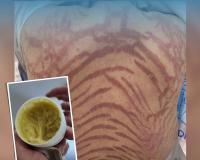 କ୍ରିମ ବଦଳାଇଲା ଜୀବନ