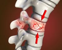 ଚର୍ବିରୁ ହାଡ