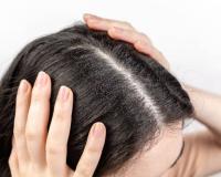 ଶୀତଦିନେ ନିଅନ୍ତୁ କେଶର ଯତ୍ନ