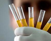 ଲାବ୍‌ରେ ପ୍ରସ୍ତୁତ ହେବ ରକ୍ତ