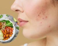 ଖାଦ୍ୟ ରୋକିବ ବ୍ରଣ ସମସ୍ୟା