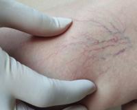 ନୀଳ ଶିରା