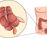 ଆପେଣ୍ଡିକ୍ସ