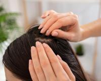 ଦୂର କରନ୍ତୁ ରୂପି ସମସ୍ୟା