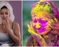 ହୋଲି ପରେ ନିଅନ୍ତୁ ତ୍ବଚାର ଯତ୍ନ