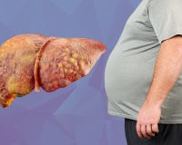 ନନ୍-ଆଲକୋହଲିକ୍ ଫ୍ୟାଟି ଲିଭର