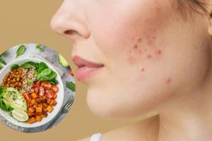 ଖାଦ୍ୟ ରୋକିବ ବ୍ରଣ ସମସ୍ୟା