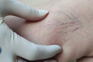 ନୀଳ ଶିରା