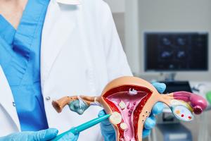 ୟୁଟେରାଇନ୍ ଫାଇବ୍ରଏଡ୍ସ